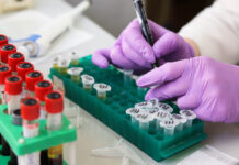 Скрининг болезни Фабри: как выявить опасную генетику на ранней стадии