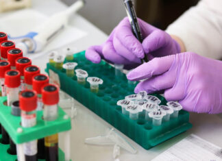 Скрининг болезни Фабри: как выявить опасную генетику на ранней стадии