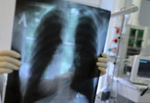 Мир вновь оказался во власти туберкулеза