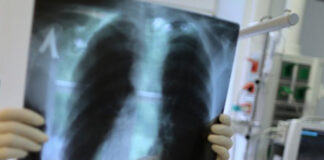 Мир вновь оказался во власти туберкулеза