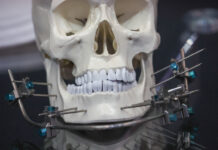 Врач объяснила, может ли ношение брекетов состарить лицо человека