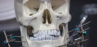 Врач объяснила, может ли ношение брекетов состарить лицо человека