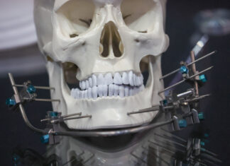 Врач объяснила, может ли ношение брекетов состарить лицо человека